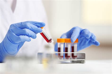 analysis laboratory health|how do laboratory tests work.